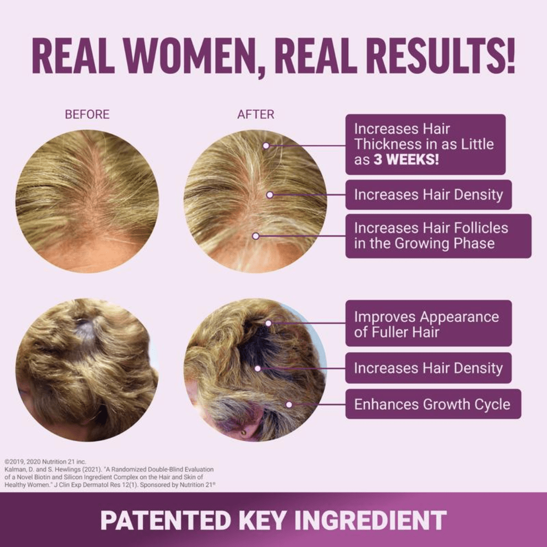 Hair Growth Accelerator — Clinically Proven Riva® Formula