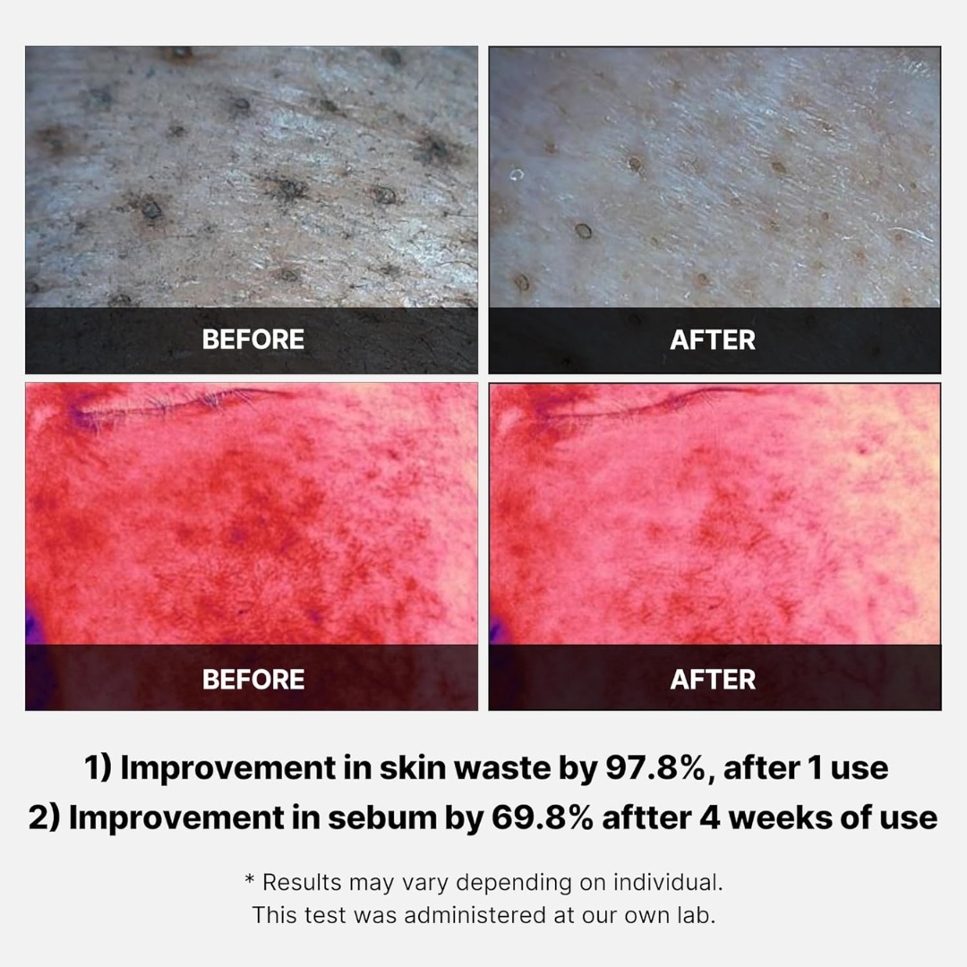 Red Succinic Acid Panthenol Facial Peeling Pads