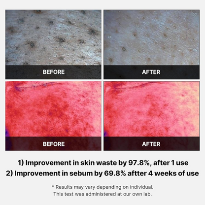 Red Succinic Acid Panthenol Facial Peeling Pads
